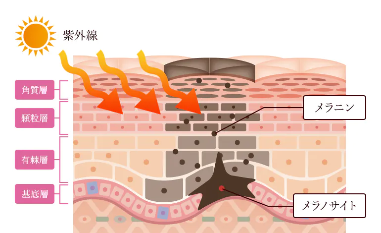 シミの原因について