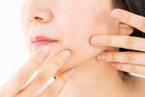 皮膚の働きについて