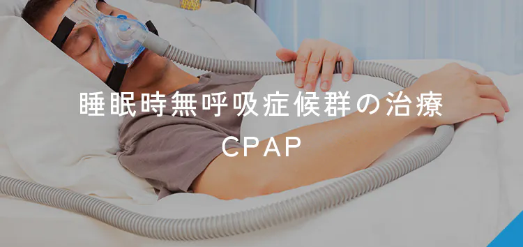 睡眠時無呼吸症候群の治療 CPAP