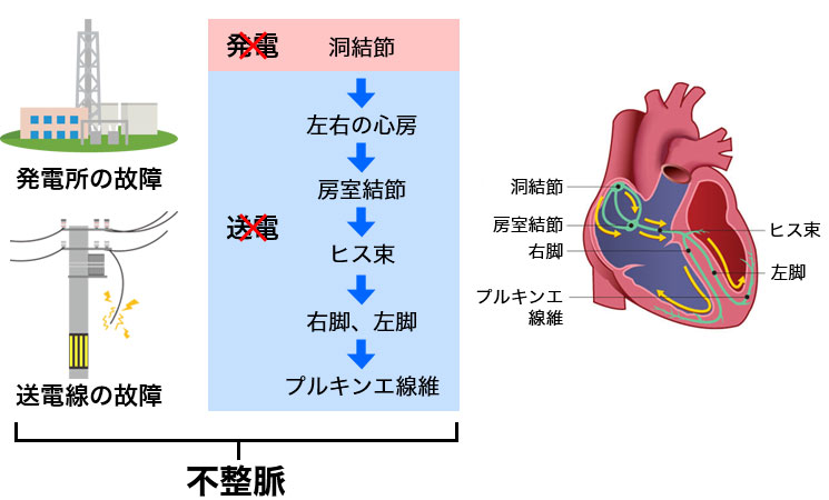 不整脈＝発電＆送電システムの故障