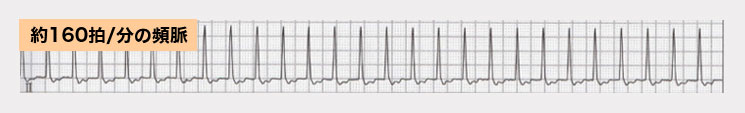 cardiovascular_03_07