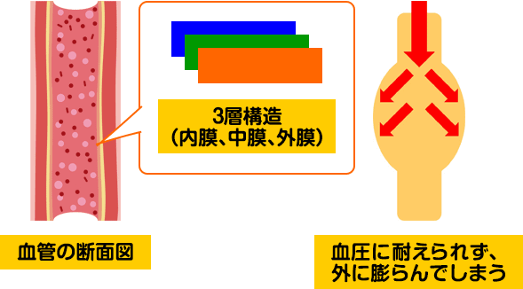 大動脈の血管構造