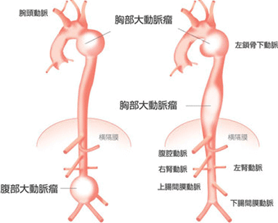 大動脈の血管構造
