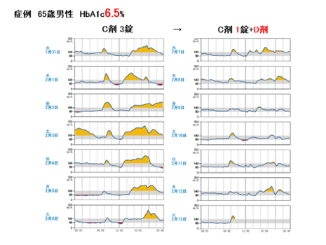 食後の高血糖や寝ている時間の低血糖