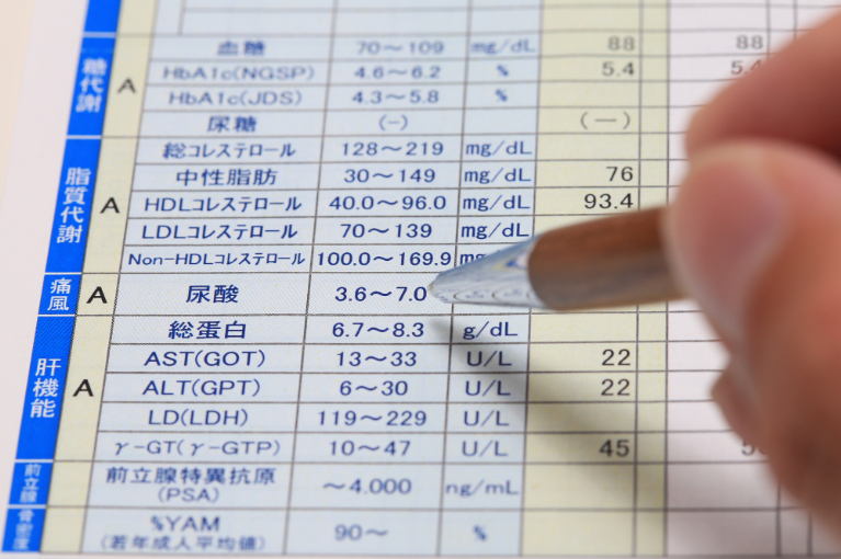 尿酸値を指摘されたらすぐに受診した方がいいですか？