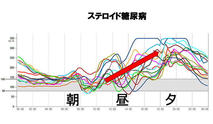 お薬で糖尿病になる？