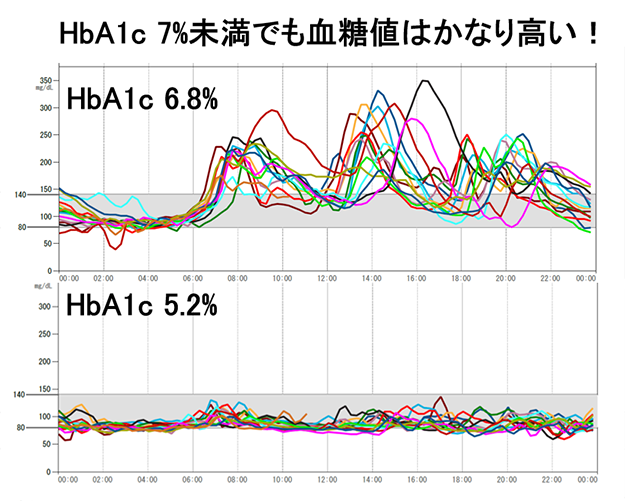 HbA1c 7%未満でも血糖値はかなり高い！