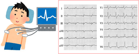心電図での検査はどのようにして行いますか？