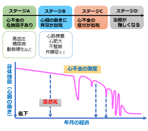 心不全は、発症前に予防するという意識が大切