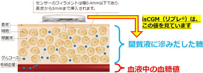 注意！ isCGM（リブレ®）の値は、採血による血糖値の代用にはなりません