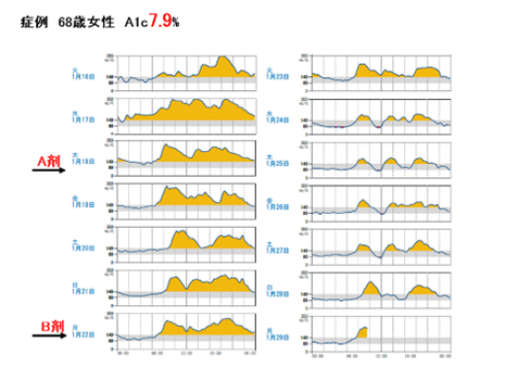 持続血糖測定器による治療のタイミング