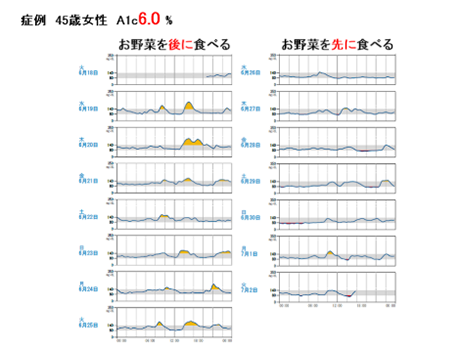 持続血糖測定器による治療のタイミング