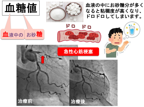 糖尿病でのどが渇く理由