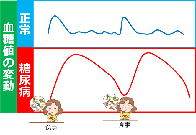 血糖値の変動