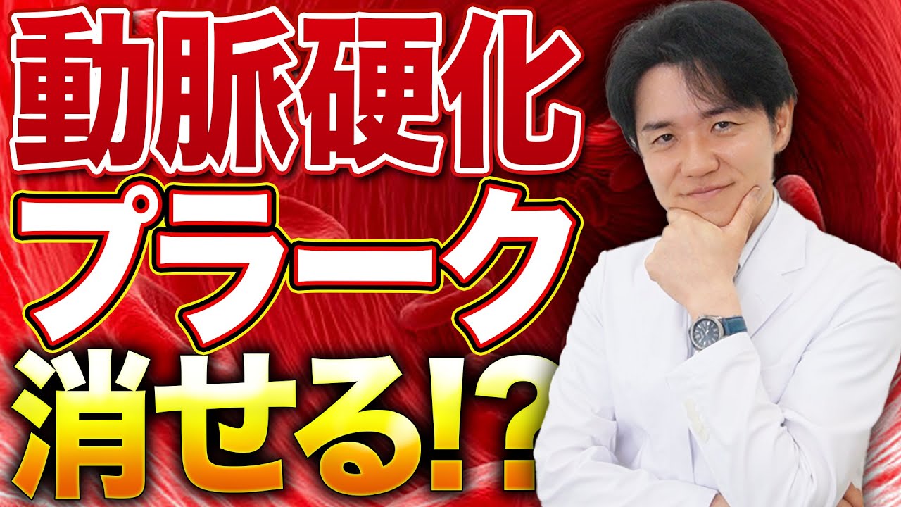 動脈硬化のプラークは一度できたら消せるのか？【べっぷ内科】